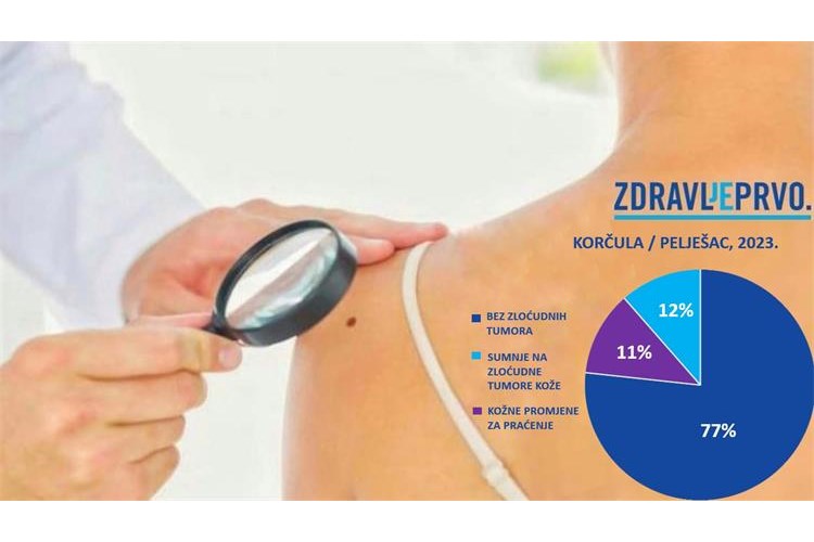 Slika /2023 OBJAVE/Rano otkrivanje melanoma_Korčula_vizual.jpg